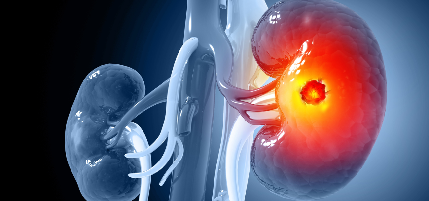 Minimally invasive Gynecological  Surgeries